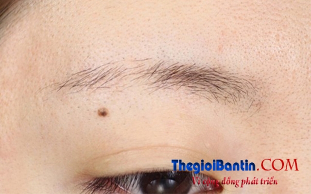 bestie-tuong-ngheo-1-20160812153422