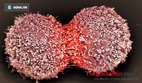 photo-0-1487855981153